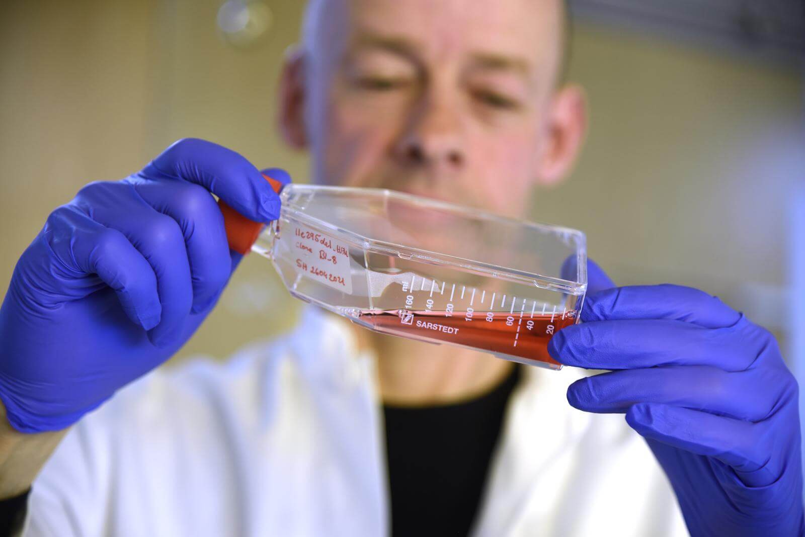 Thomas holder en beholder med rød væske, som er næringsvæske for celler