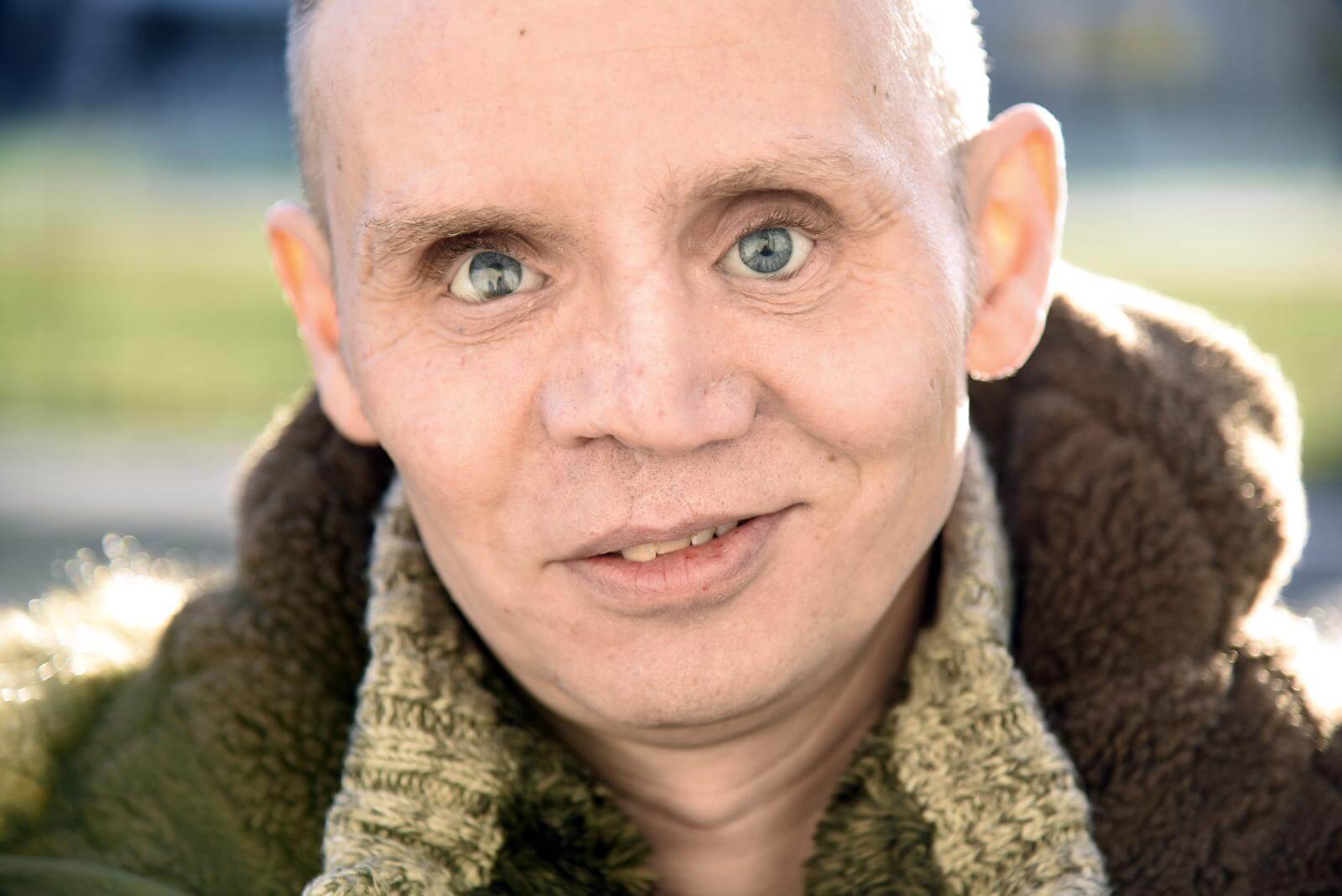 Portræt af Michael der blev blind ved en fyrværkeriulykke